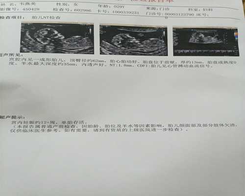 广州试管代生包男孩机构,我的泰国试管艰辛经历,2次宫外孕,2促3移终成正果_卵