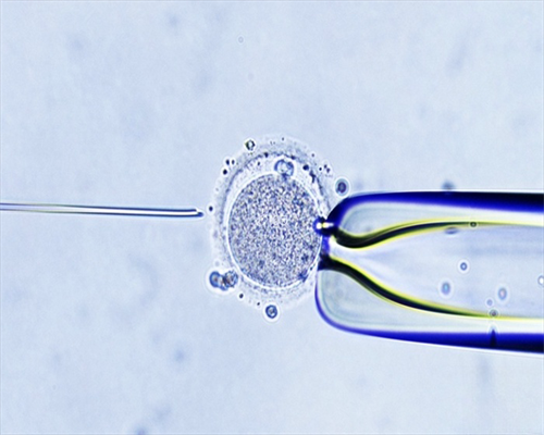 地下供卵机构_供卵试管要多少钱,绍兴卵巢储备功能下降可以做供卵试管吗，可