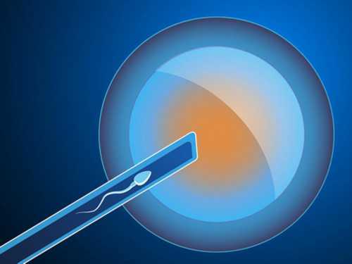 二代试管费用_日本捐卵试管,二代试管婴儿成功,一代试管婴儿成功率